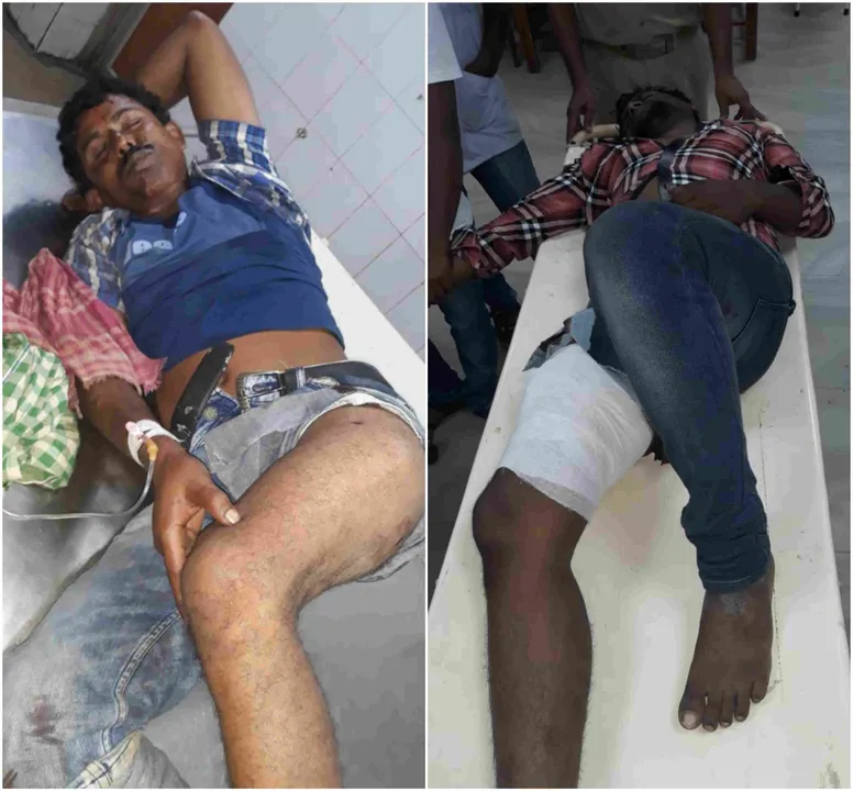  Two notorious criminals injured in Bhubaneswar encounter