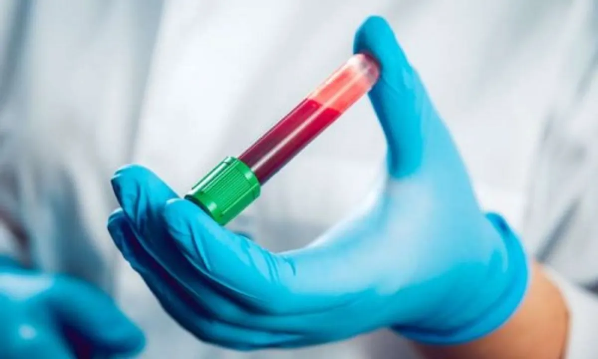  COVID-19: Rapid Antibody test in Bhubaneswar soon