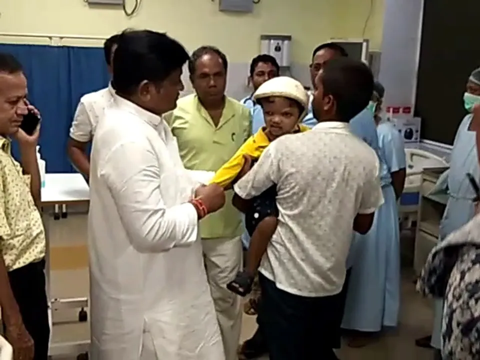  One of separated twins Jaga to undergo skull transplant surgery
