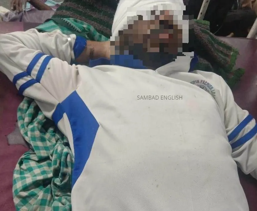  Girl throws acid on youth in Odisha's Cuttack