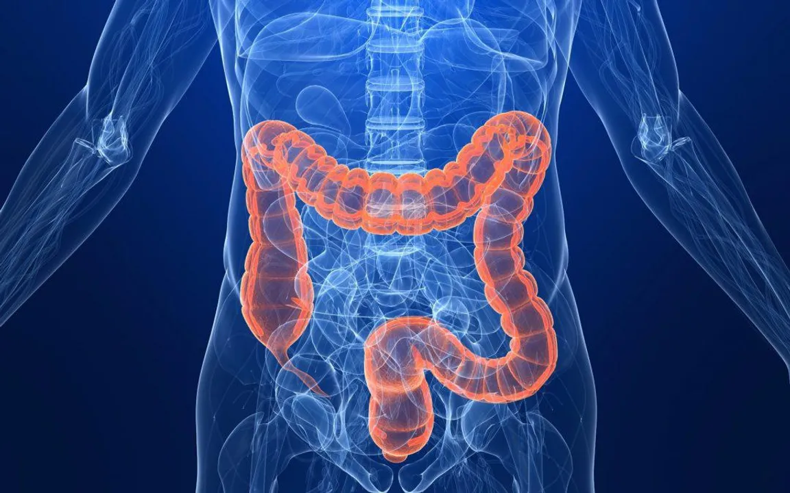  High-fat diet may increase colon cancer risk