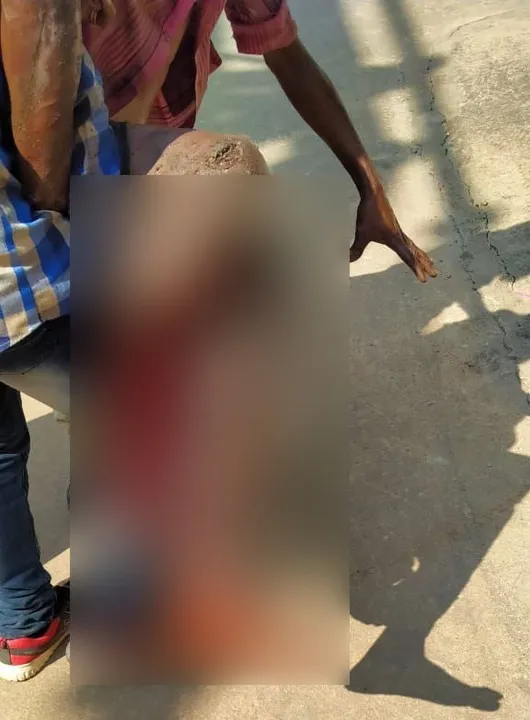  Worker's leg severed after mishap at NALCO plant