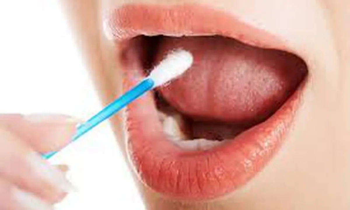  Saliva test can detect mouth, throat cancer early
