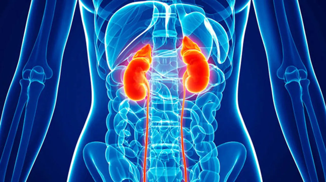  Chronic kidney disease killing over 1mn people worldwide