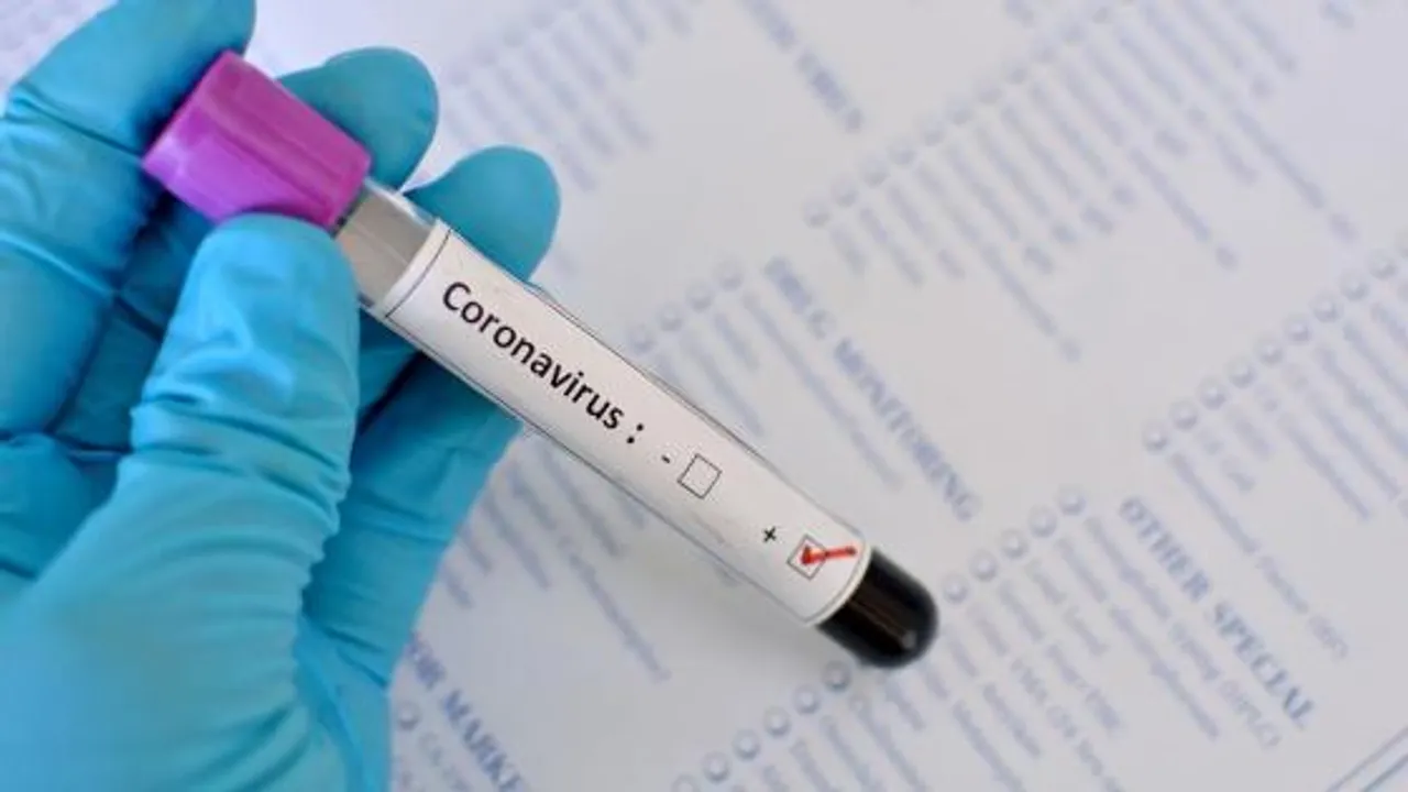  2 women test positive taking COVID-19 cases to 47 in Maharashtra