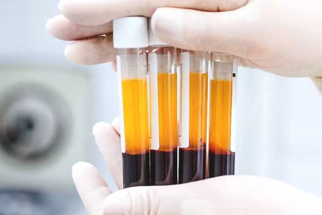  Plasma therapy safe and effective for Covid patients: Study