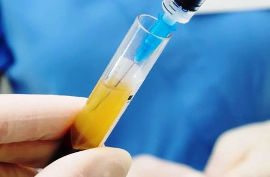  Understanding Plasma Therapy