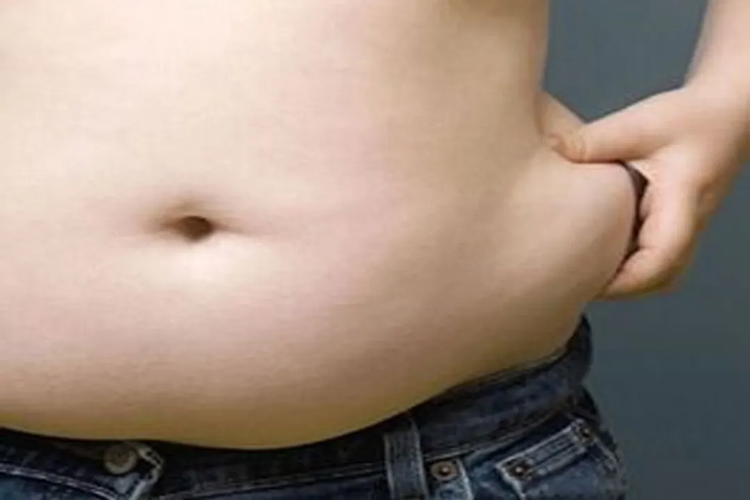  Mortality high among obese people infected with Covid-19: Researchers