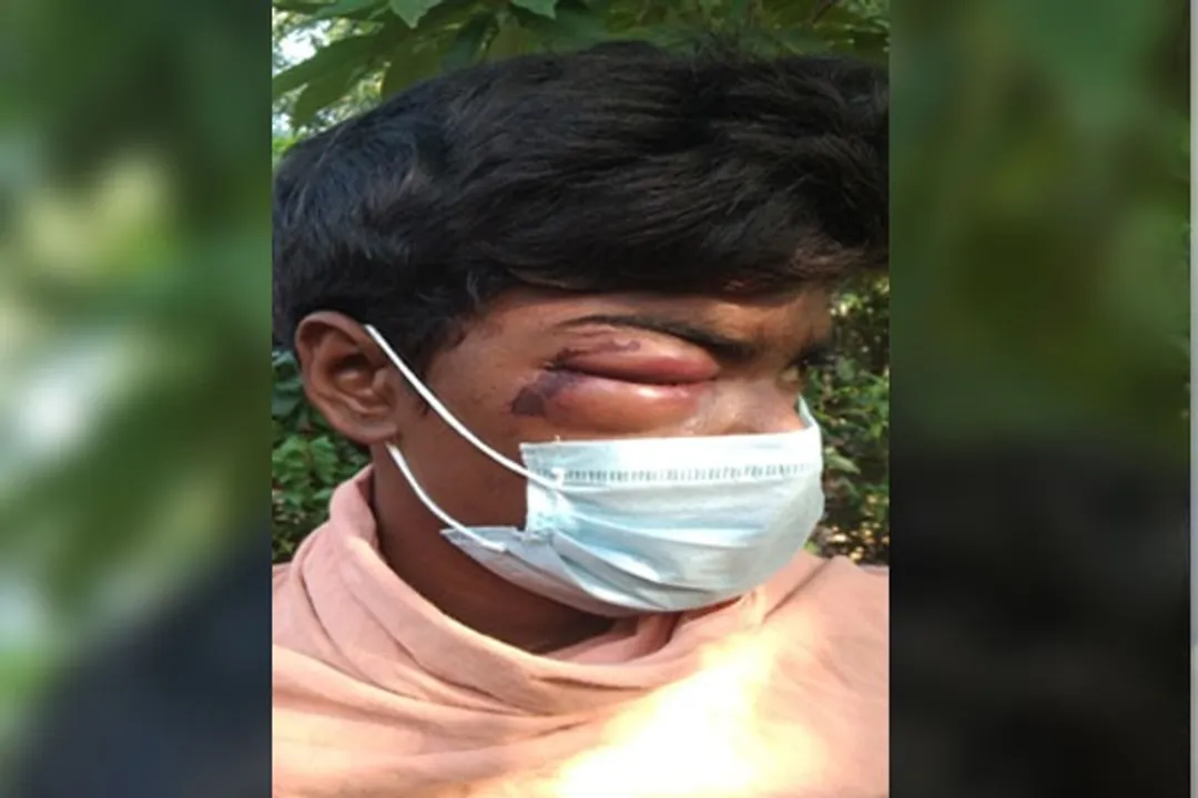  Odisha youth loses vision after being thrashed by cops