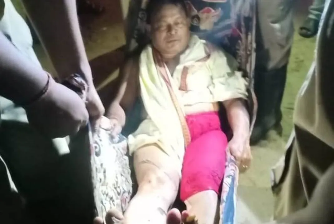  Odisha: Man critical after fire breaks out from earthen lamp in house