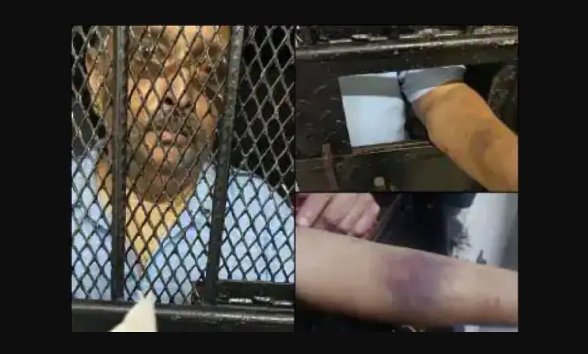  Shocking pictures of fugitive Mehul Choksi emerge; injury marks cover face and shoulders