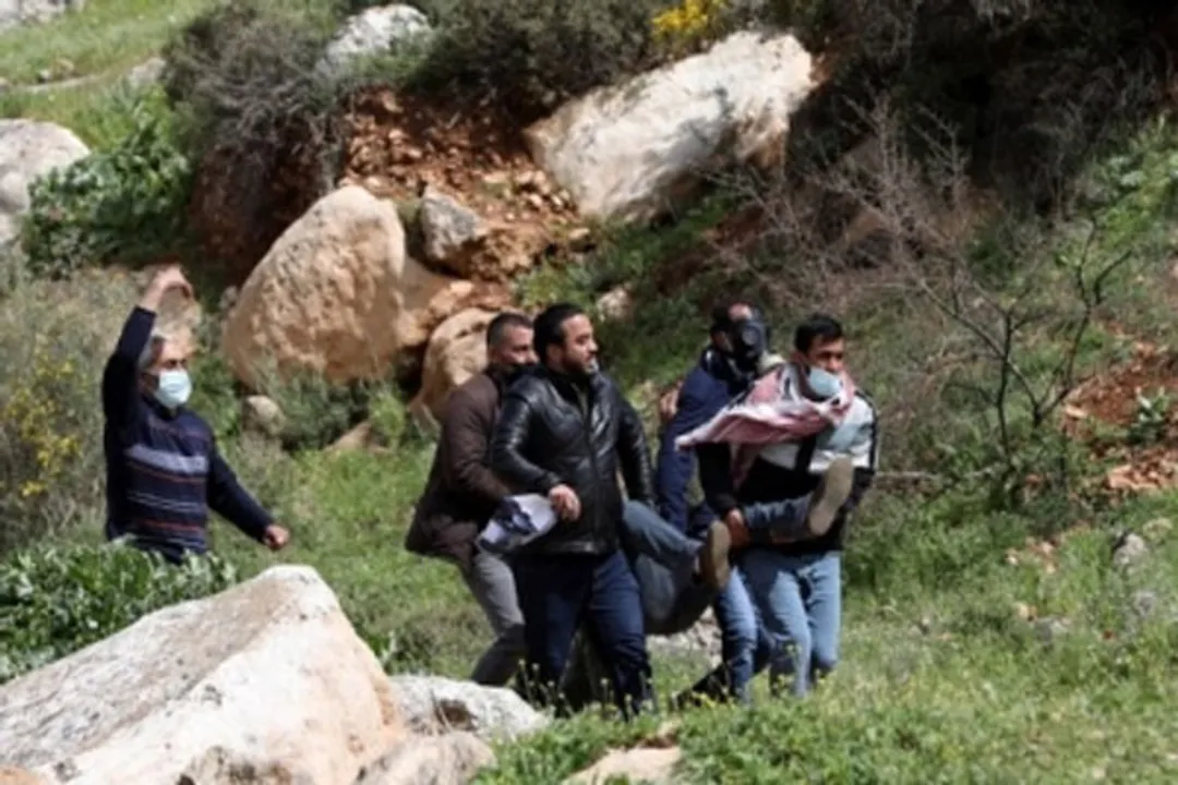  West Bank clash leaves 217 Palestinian protesters injured