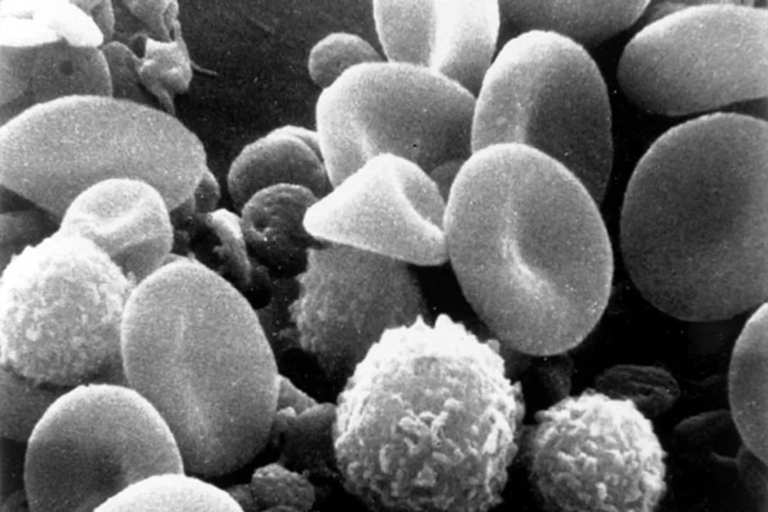 White blood cells can help predict Covid-19 severity. Here's how