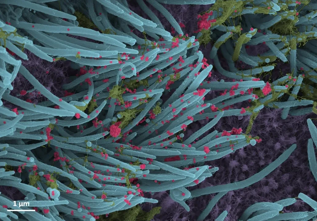  Lethal 'NeoCov' Covid variant only 1 mutation away from infecting humans: Wuhan scientists