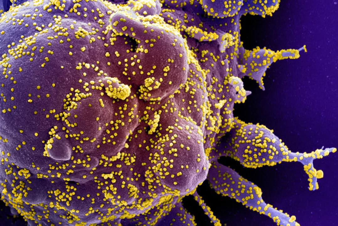  'Deltacron' variant is a lab contamination, not a new strain: UK virologist