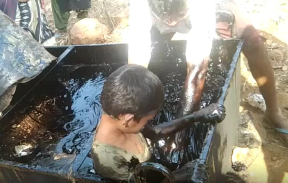  3 children fall into molten tar container in Odisha's Keonjhar