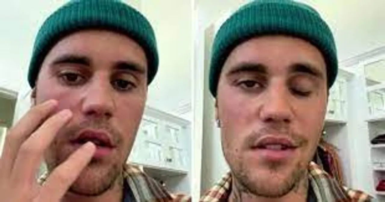  Justin Bieber suffers from facial paralysis, cancels shows