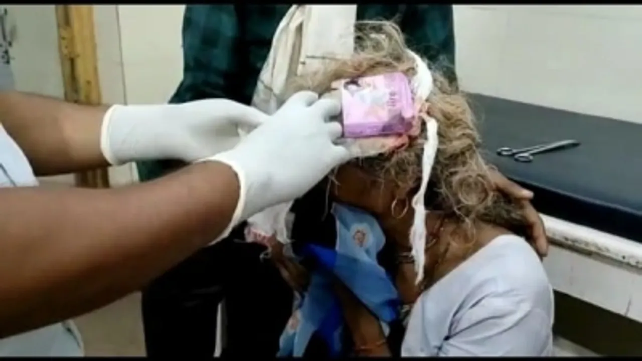  Woman's head wound dressed with condom pack at hospital in Madhya Pradesh