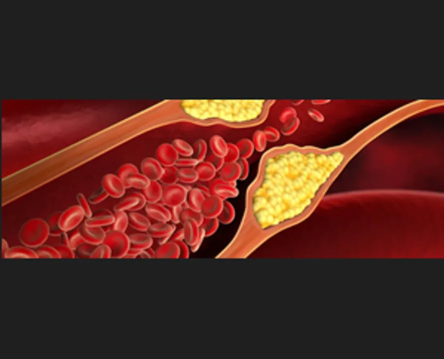  Indian researchers find a new, cheaper route to manage cholesterol