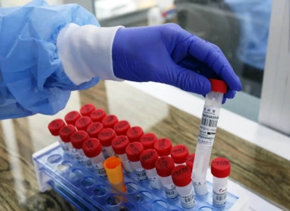  New study explores AI in developing antibiotics with less side-effects