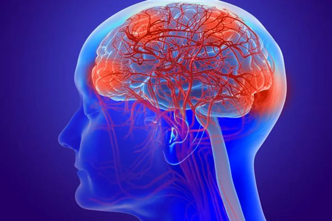  Cognitive impairment due to Covid-19 equivalent to 20 years of ageing: Study