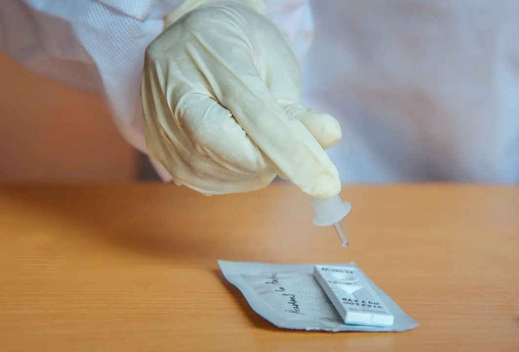  TB surfaces in 2nd wave Covid patients in India