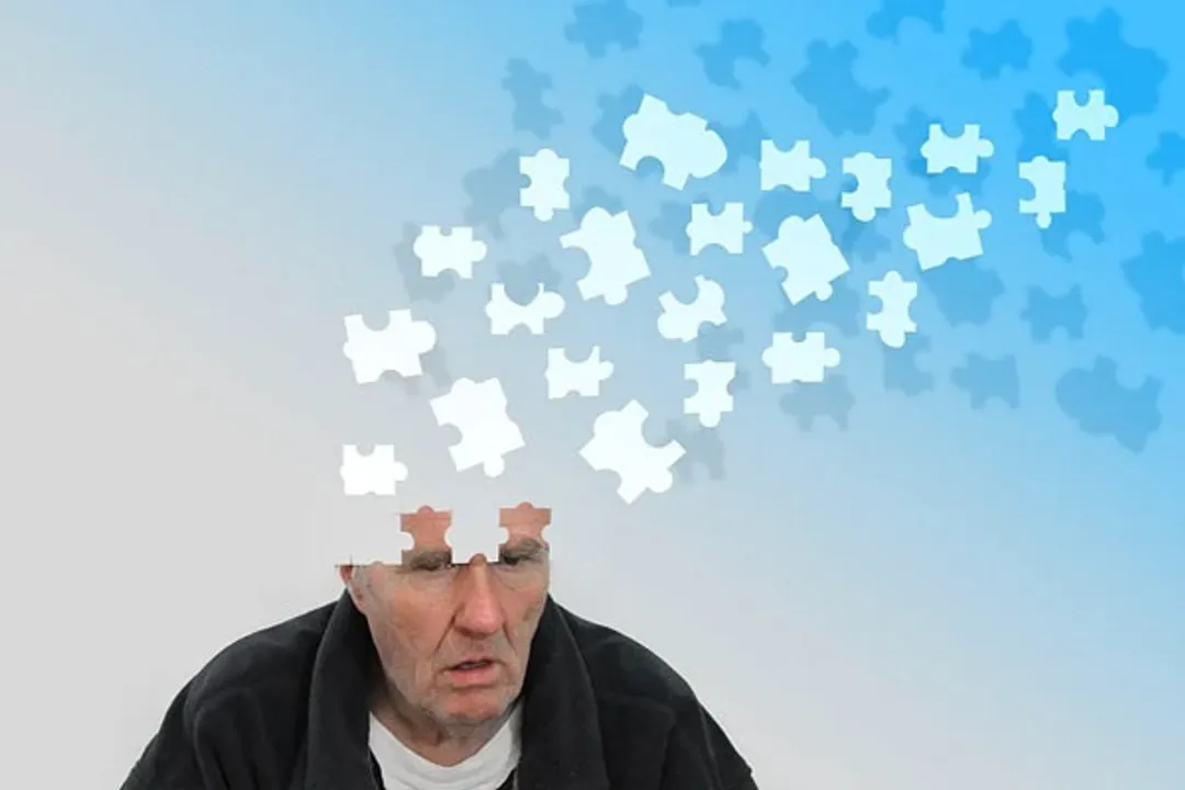  Dementia linked with Covid-related death in large study