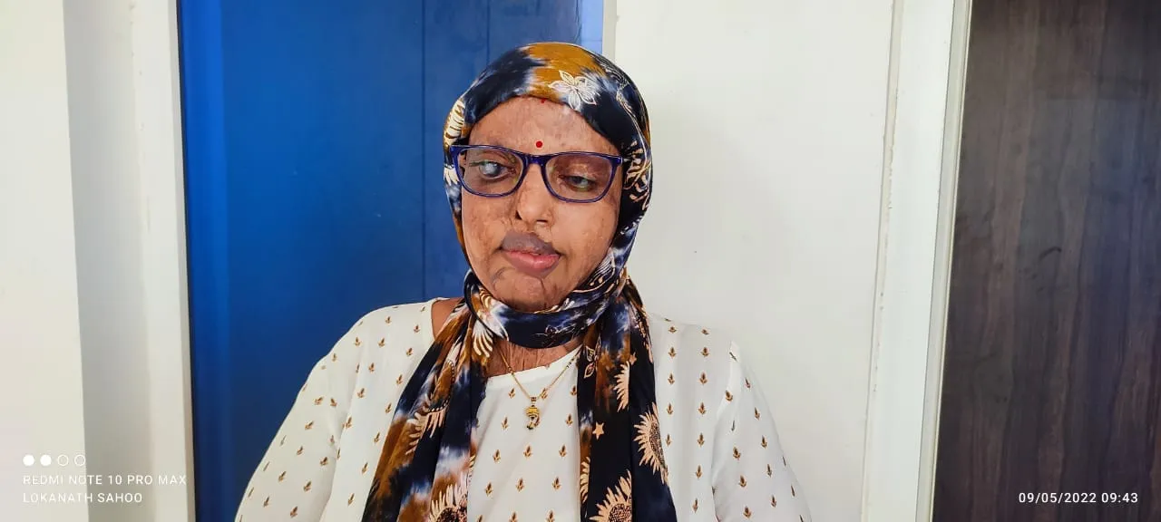  Pramodini Roul acid attack case: Prime accused gets 14-year RI