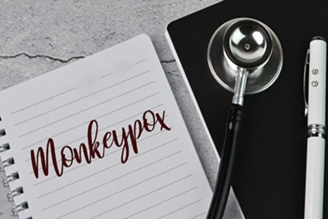  Monkeypox may slow down but not be eliminated: Report
