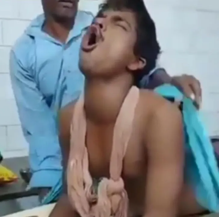  Man starts 'barking' after six months of dog bite in Odisha's Cuttack