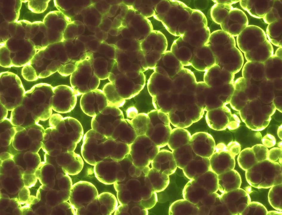  5 bacteria behind at least 6.8 lakh deaths in India in 2019: Lancet