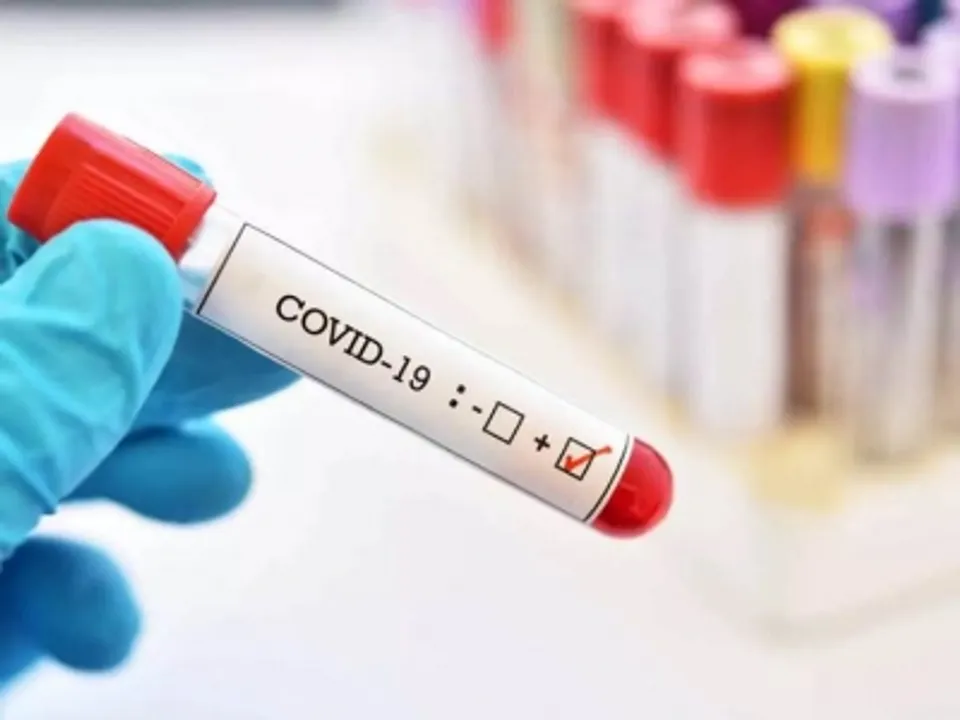  Tourist from Argentina tests Covid positive, goes missing