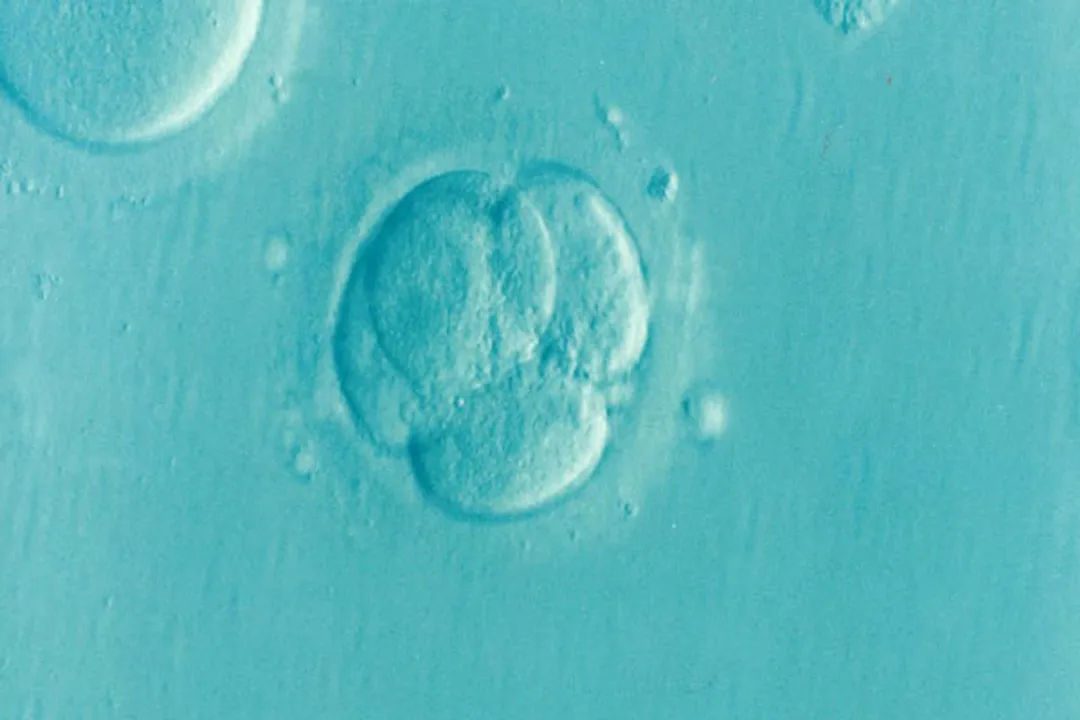  A common cause of infertility, you've probably never heard of