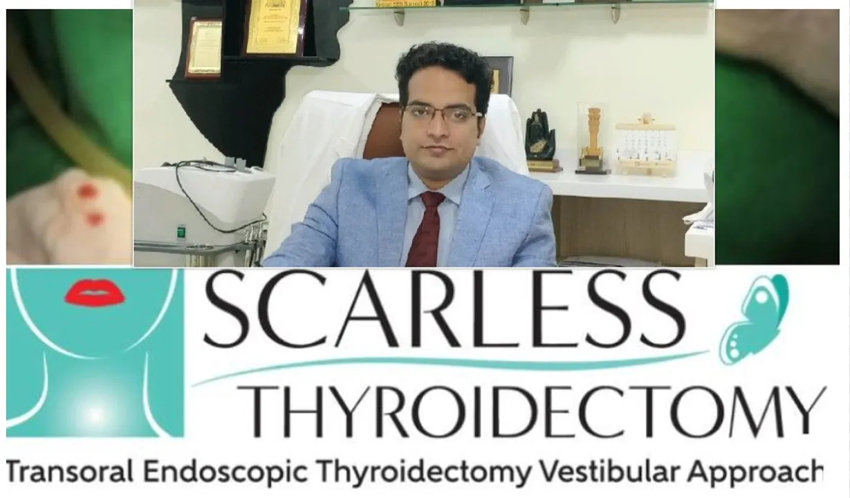  TET - The only true scarless thyroid surgery