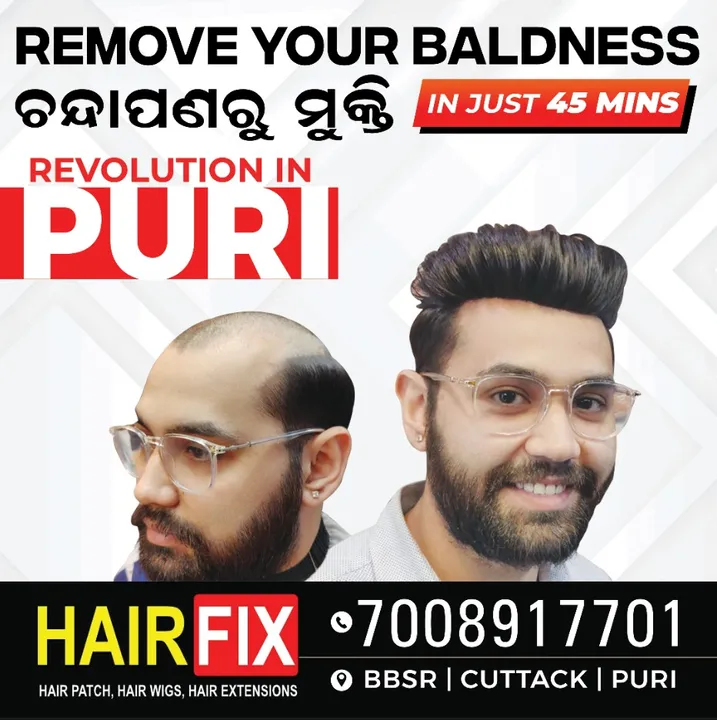  Worried about baldness?