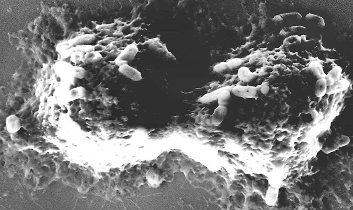  ILS Bhubaneswar researchers discover new probiotic bacteria