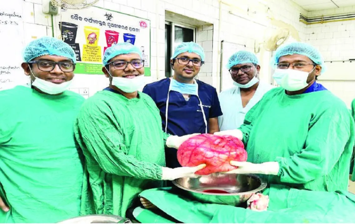  8kg tumour removed from minor girl’s abdomen in Bhubaneswar