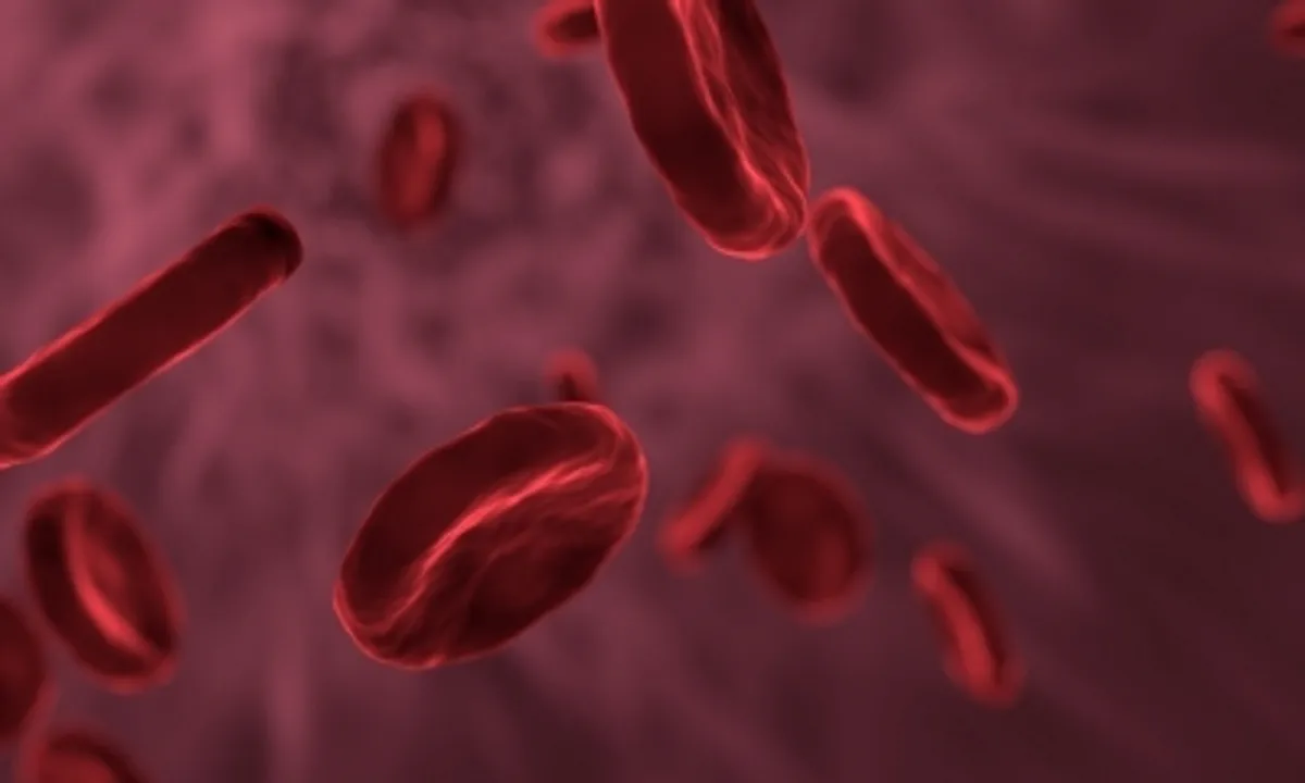 Screening, awareness on stem cell therapy to help fight sickle cell disease