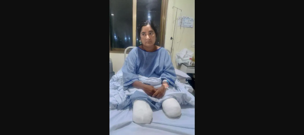  Tortured by Odisha cadre IPS officer's wife, woman cop loses limbs in suicide bid
