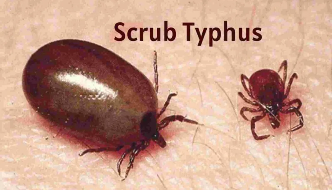  Scrub typhus claims 5 lives in Odisha’s Bargarh
