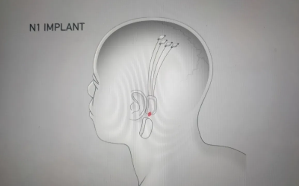  Musk’s Neuralink now recruiting for 1st human trial of its brain-computer interface