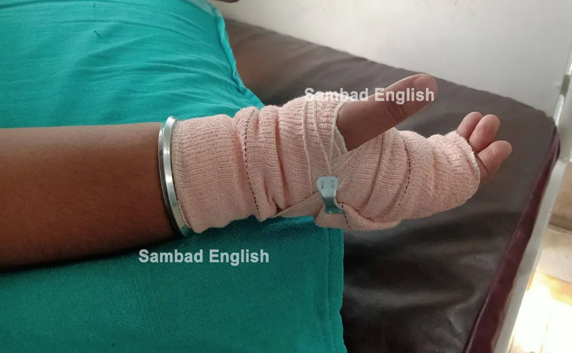  Girl student of private school sustains injuries after being beaten in Odisha’s Rourkela