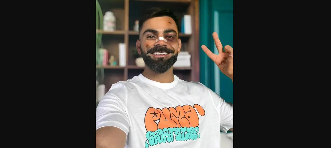  Virat Kohli posts Instagram pic with 'swollen eyes', band-aid on nose; Here's the truth behind the photo