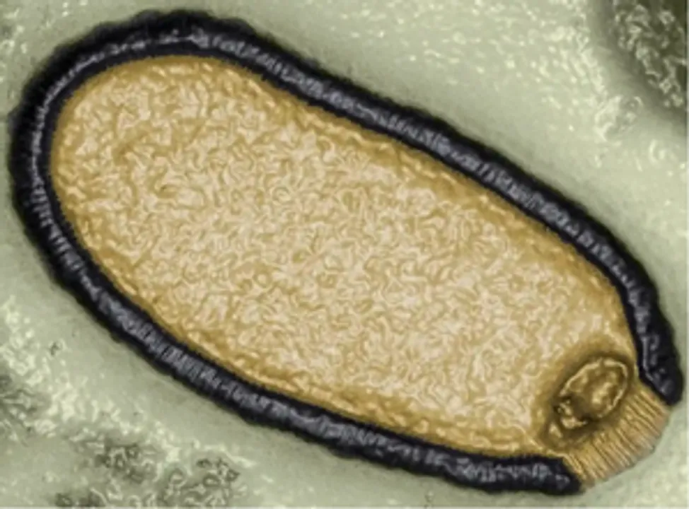  Ancient zombie viruses frozen in Siberia may trigger new pandemic: Study
