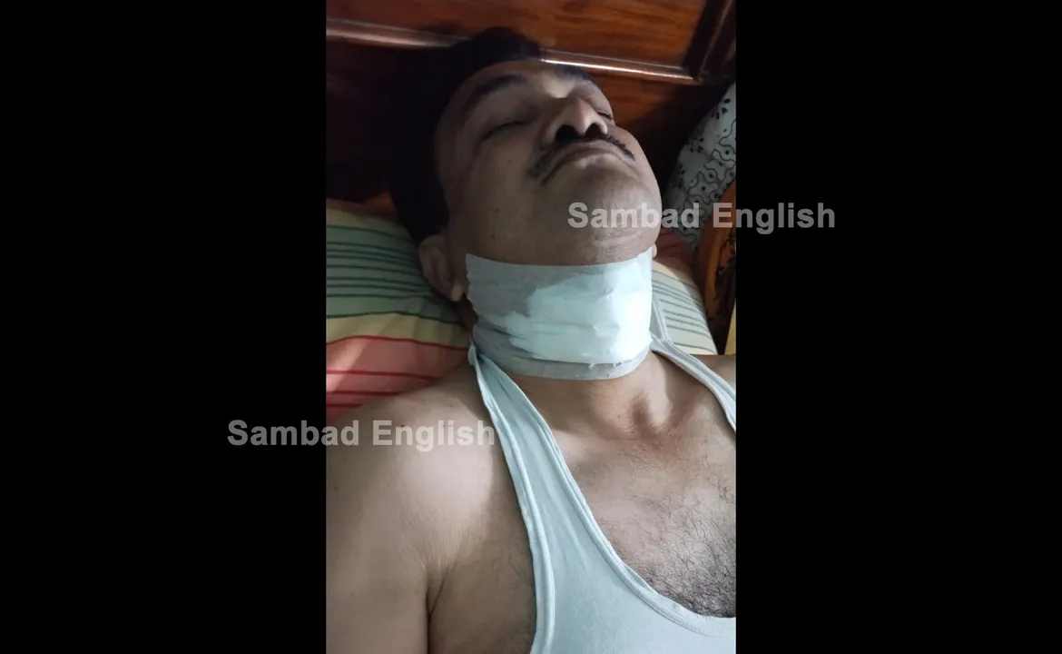  Kite string: Man critical after his throat gets slit by Manja thread in Odisha’s Cuttack