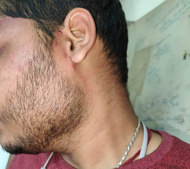  Ragging at MKCG Medical College: First year student thrashed by seniors; complaint filed