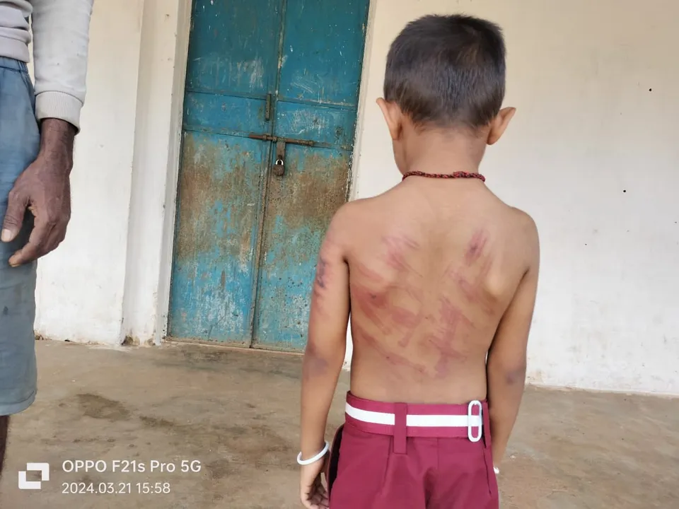  Odisha teacher held for meting out corporal punishment to nursery student