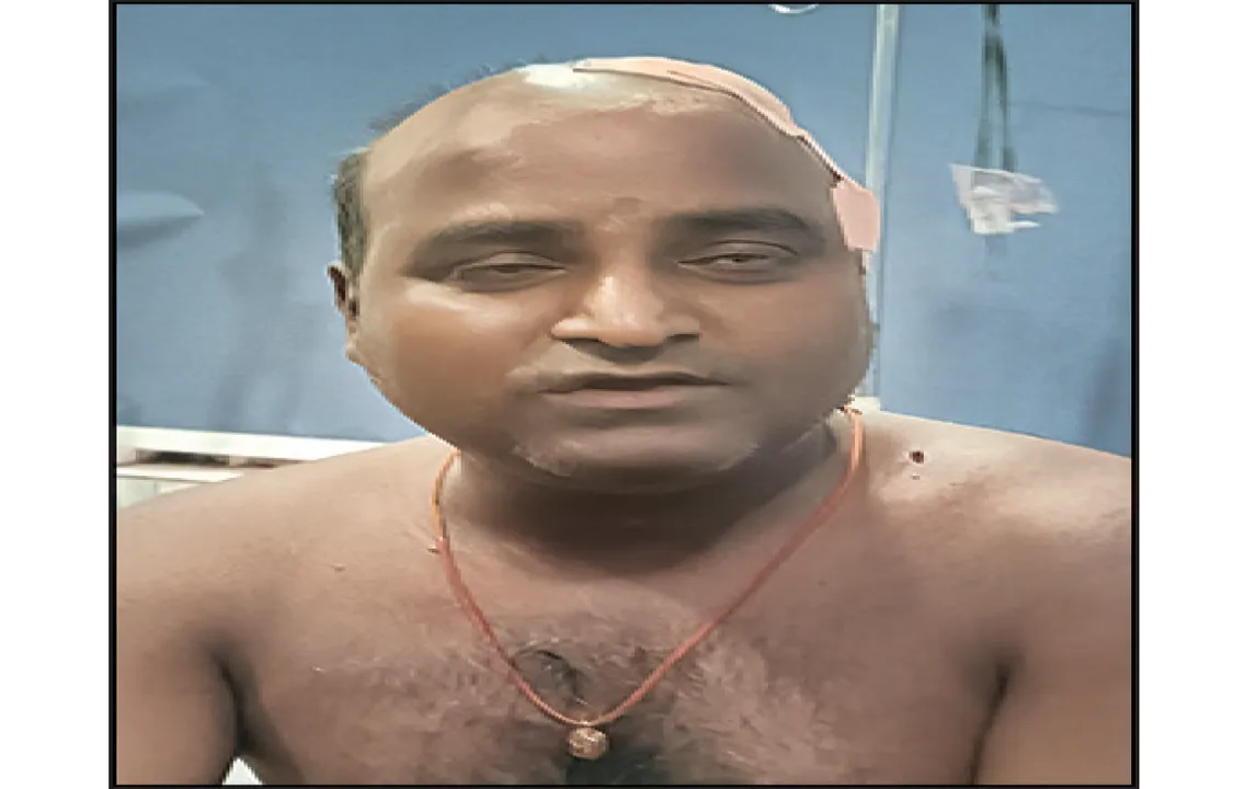  ବ୍ୟାଙ୍କ ଗାଡ଼ିରୁ ଲୁଟ୍‌ ଉଦ୍ୟମ: ଲଢ଼ିଲେ ସୁରକ୍ଷାକର୍ମୀ, ୩୮ ଲକ୍ଷ ଟଙ୍କା ସୁରକ୍ଷିତ