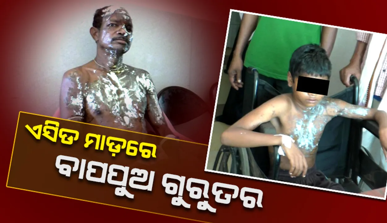 ଘରେ ଶୋଇଥିବା ବେଳେ ଏସିଡ ମାଡ଼, ବାପା ଓ ପୁଅ ଗୁରୁତର