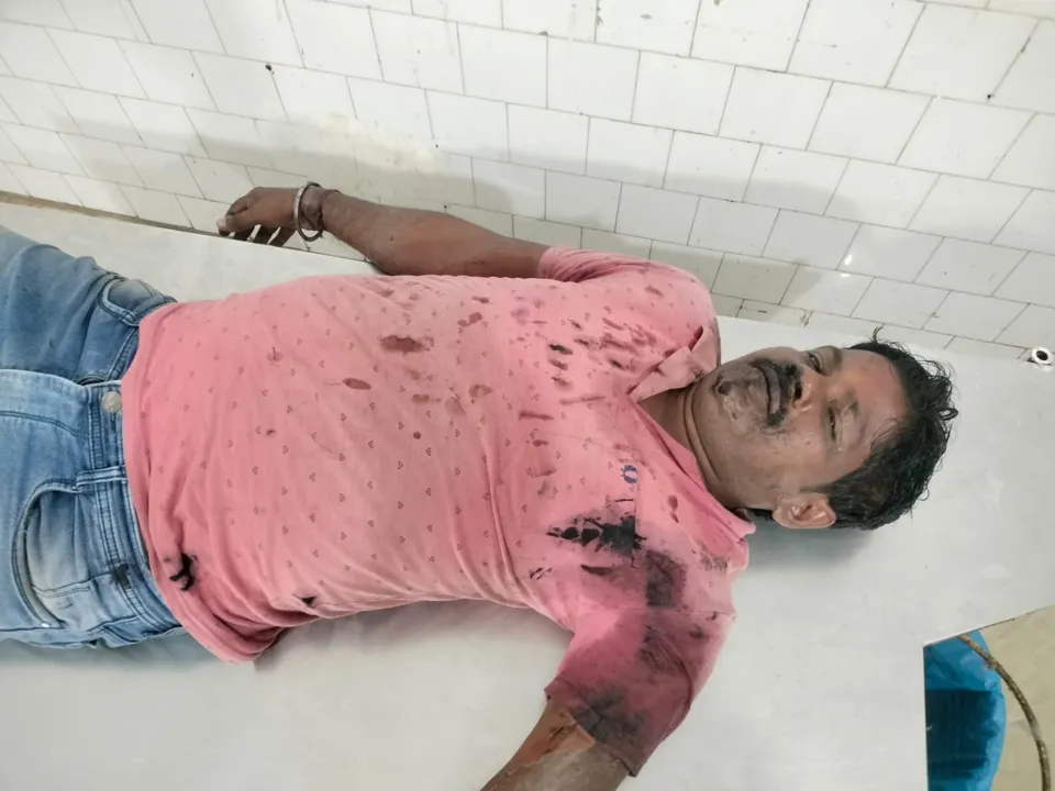 ସାମାନ୍ୟ ବଚସାରୁ ଏସିଡ ମାଡ଼